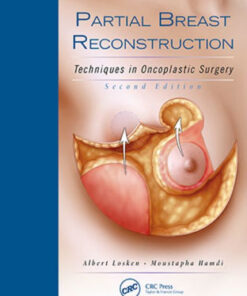 Partial Breast Reconstruction 2nd Edition by Albert Losken