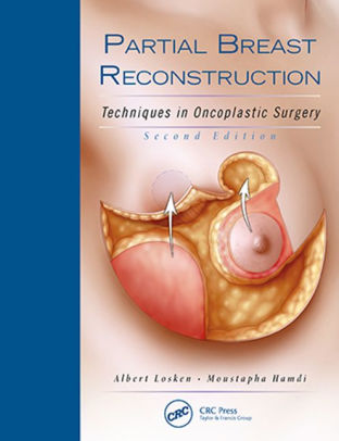Partial Breast Reconstruction 2nd Edition by Albert Losken