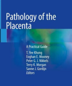 Pathology of the Placenta by T. Yee Khong