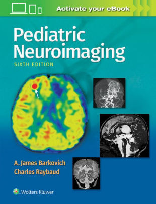 Pediatric Neuroimaging 6th Edition by A. James Barkovich