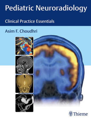 Pediatric Neuroradiology - Clinical Practice Essentials by Choudhri
