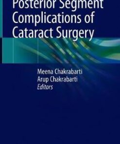 Posterior Segment Complications of Cataract Surgery by Chakrabarti