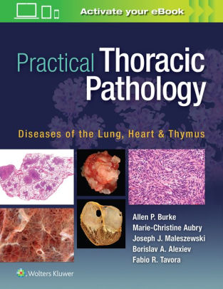 Practical Thoracic Pathology by Allen P. Burke