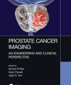 Prostate Cancer Imaging by Ayman ElBaz
