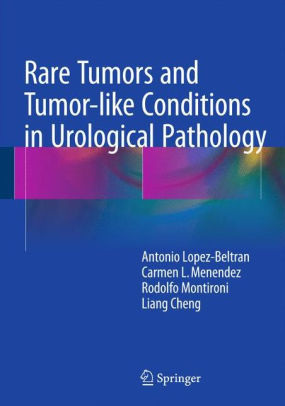 Rare Tumors and Tumor-like Conditions in Urological Pathology by Beltran