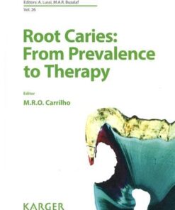 Root Caries - From Prevalence to Therapy by M. Rocha de Olivera Carrilho