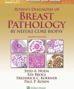 Rosen's Diagnosis of Breast Pathology by Needle Core Biopsy 4 Ed Hoda