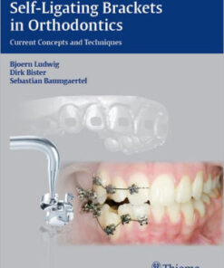 Self ligating Brackets in Orthodontics by Bjoern Ludwig