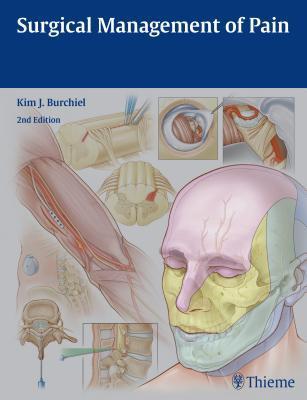 Surgical Management of Pain 2nd Edition by Kim J. Burchiel