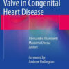 The Tricuspid Valve in Congenital Heart Disease By Alessandro Giamberti