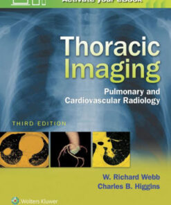 Thoracic Imaging - Pulmonary Radiology 3rd Edition by Webb