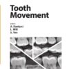 Tooth Movement By A. Kantarci