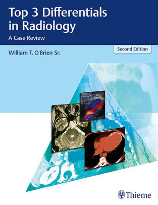 Top 3 Differentials in Radiology 2nd Edition by O'Brien