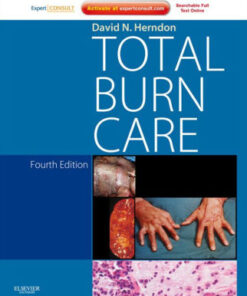 Total Burn Care 4th Edition by David N. Herndon