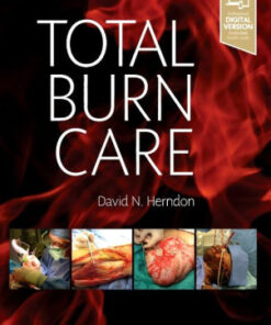 Total Burn Care 5th Edition by David N. Herndon