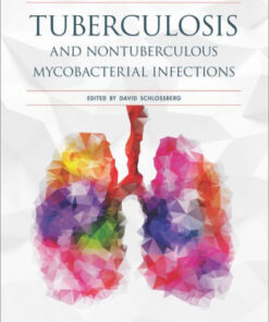 Tuberculosis and Nontuberculous Mycobacterial Infections 7 Schlossberg