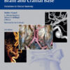 Vasculature of the Brain and Cranial Base by Walter Grand