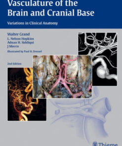 Vasculature of the Brain and Cranial Base by Walter Grand