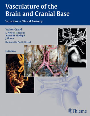 (PDF) Vasculature of the Brain and Cranial Base by Grand | Booksdo.com