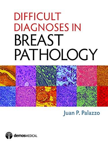 Difficult Diagnoses in Breast Pathology by Juan P. Palazzo