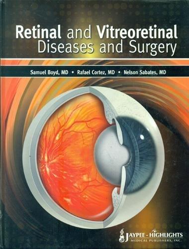 Retinal And Vitreoretinal Diseases And Surgery Boyd S.